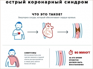 Острый коронарный синдром (ОКС)